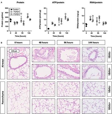 Silencing Heat Shock Protein 47 (HSP47) in Fibrogenic Precision-Cut Lung Slices: A Surprising Lack of Effects on Fibrogenesis?